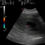 Mehr über den Artikel erfahren Das Geheimnis ist gelüftet…..