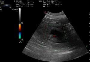 Mehr über den Artikel erfahren Das Geheimnis ist gelüftet…..